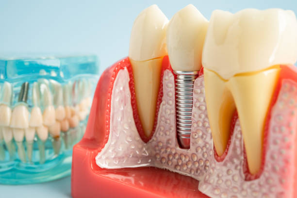 Our Range of Dental Services in Bexley, OH